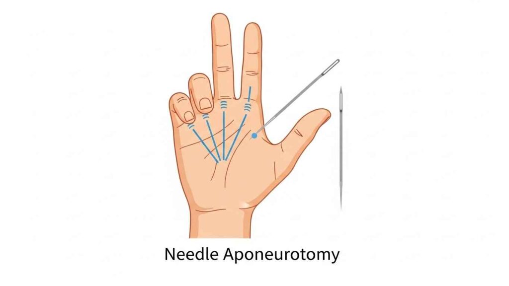 Life After Treatment What to Expect